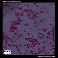 Neisseria meningitidis under microscope